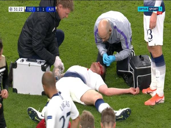 Những chấn thương đáng tiếc nhất lịch sử Tottenham